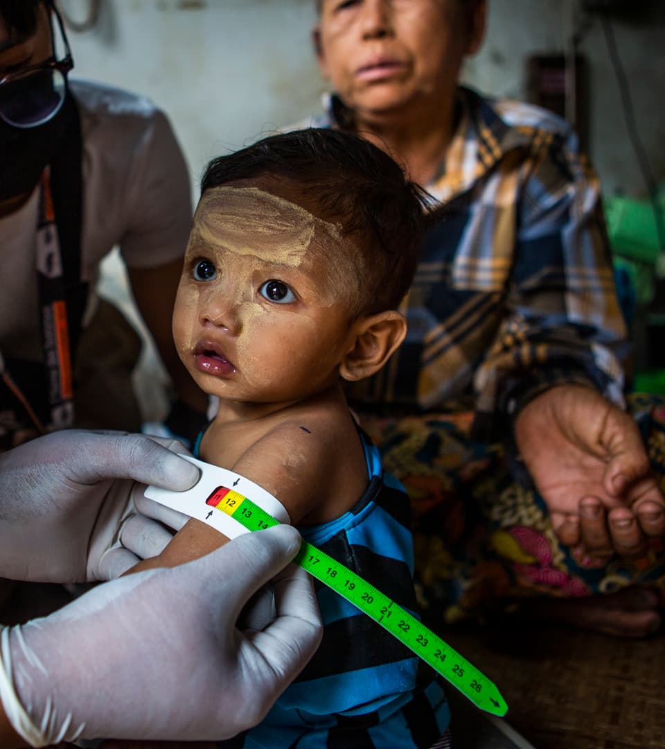 Together against malnutrition in Myanmar