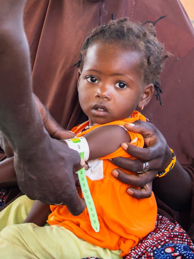 Burkina Faso malnutrition